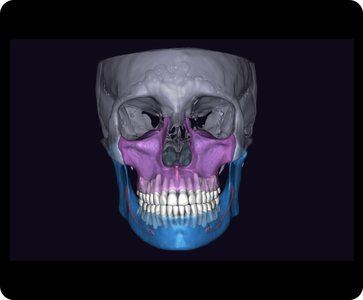 Reconstrucción de un estudio dental con segmentación por colores