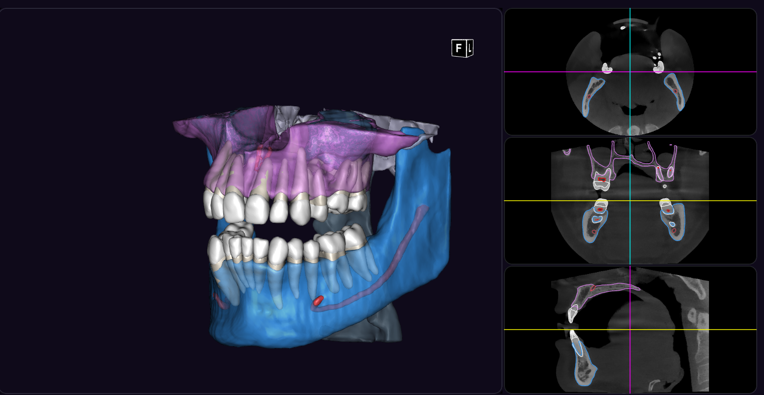 Tomografía CBCT 3D